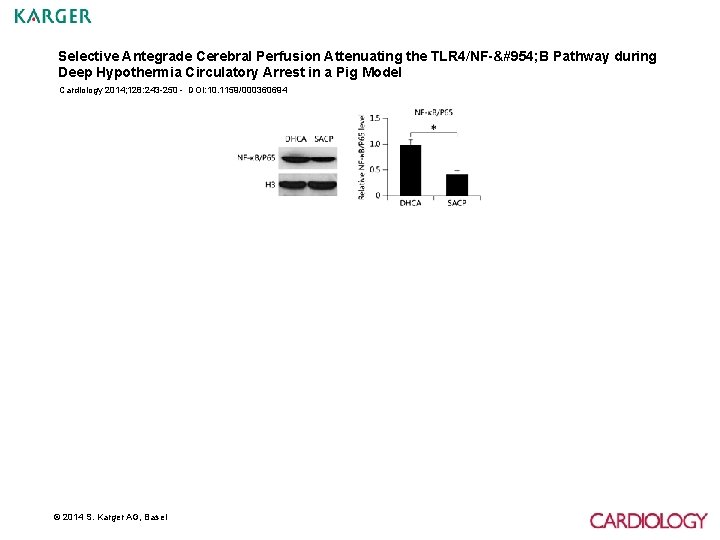 Selective Antegrade Cerebral Perfusion Attenuating the TLR 4/NF-κ B Pathway during Deep Hypothermia Circulatory