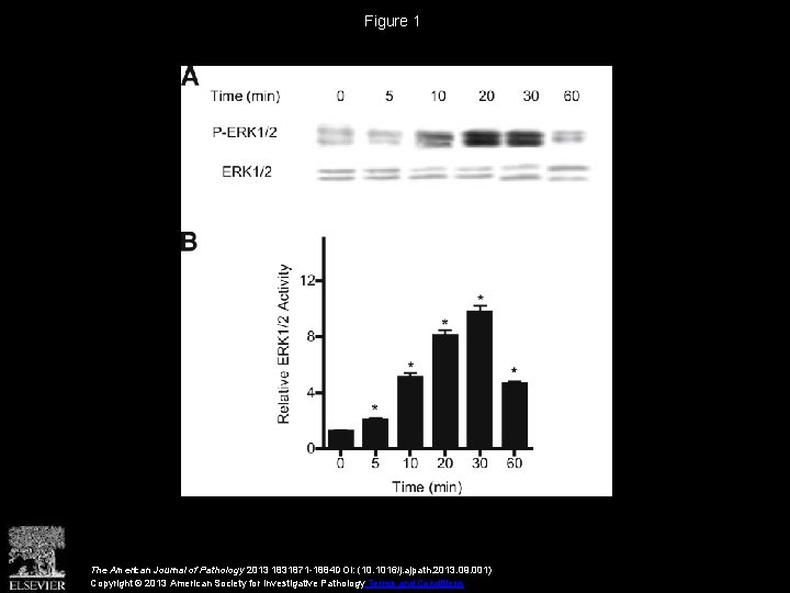 Figure 1 The American Journal of Pathology 2013 1831871 -1884 DOI: (10. 1016/j. ajpath.