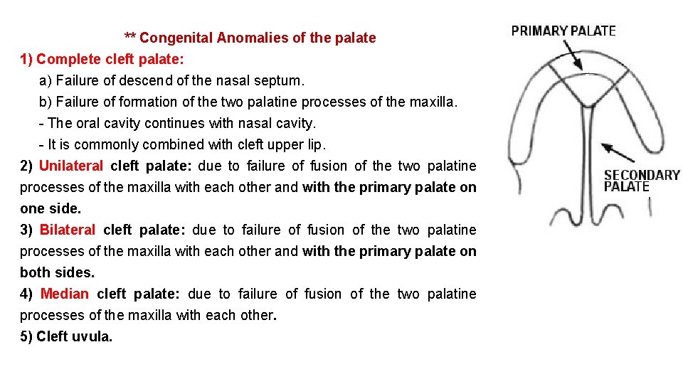 ** Congenital Anomalies of the palate 1) Complete cleft palate: a) Failure of descend ** Congenital Anomalies of the palate 1) Complete cleft palate: a) Failure of descend