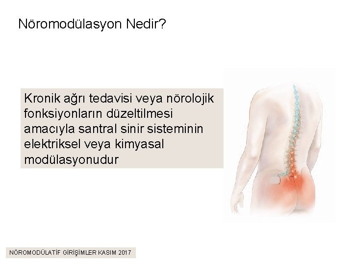 Nöromodülasyon Nedir? Kronik ağrı tedavisi veya nörolojik fonksiyonların düzeltilmesi amacıyla santral sinir sisteminin elektriksel