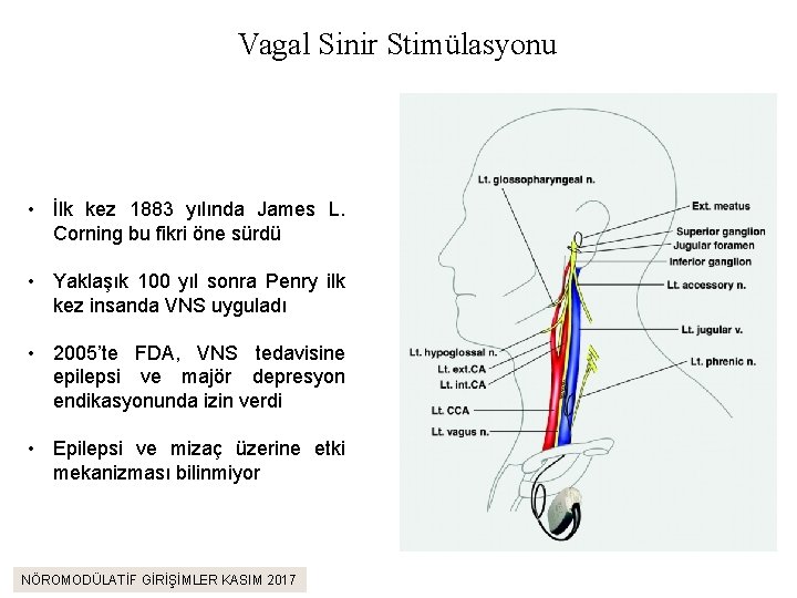 Vagal Sinir Stimülasyonu • İlk kez 1883 yılında James L. Corning bu fikri öne