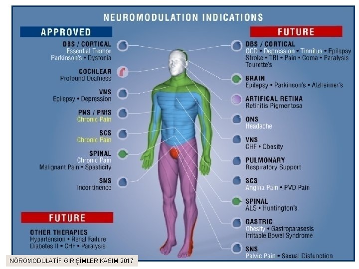 NÖROMODÜLATİF GİRİŞİMLER KASIM 2017 