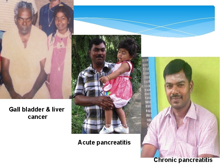 Gall bladder & liver cancer Acute pancreatitis Chronic pancreatitis 