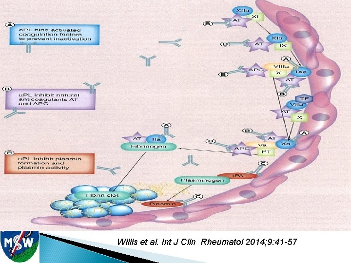 Willis et al. Int J Clin Rheumatol 2014; 9: 41 -57 