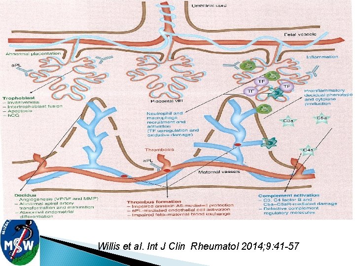 Willis et al. Int J Clin Rheumatol 2014; 9: 41 -57 