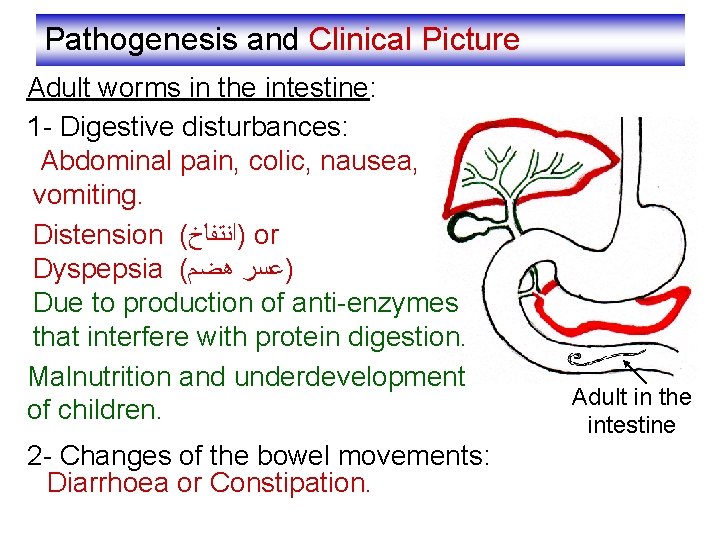 Pathogenesis and Clinical Picture Adult worms in the intestine: 1 - Digestive disturbances: Abdominal