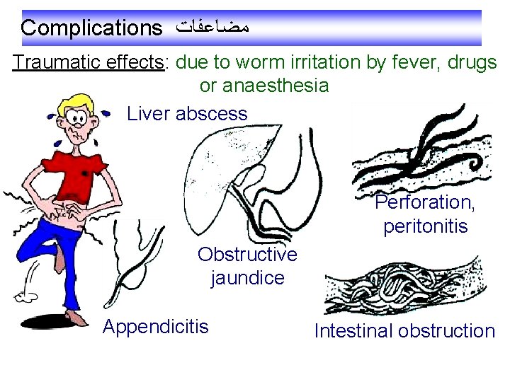 Complications ﻣﻀﺎﻋﻔﺎﺕ Traumatic effects: due to worm irritation by fever, drugs or anaesthesia Liver