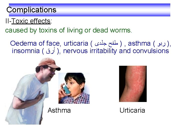 Complications II-Toxic effects: caused by toxins of living or dead worms. Oedema of face,