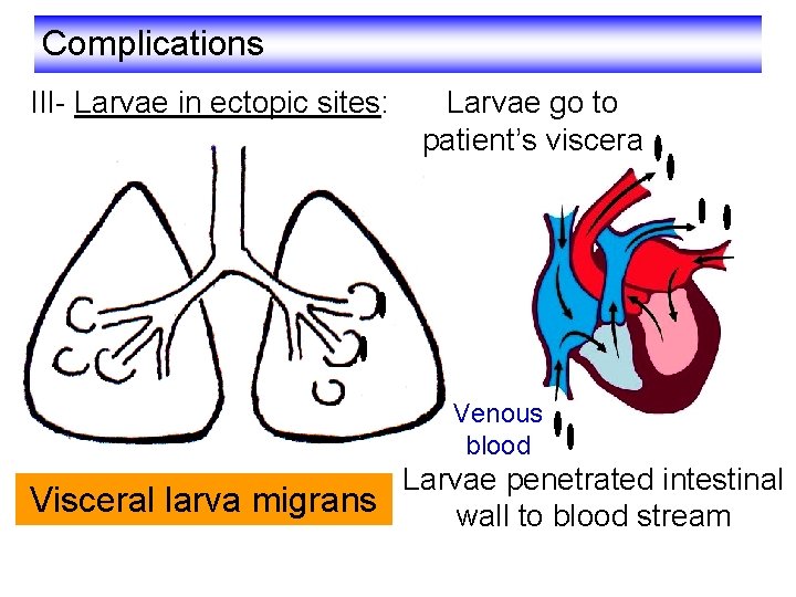 Complications III- Larvae in ectopic sites: Larvae go to patient’s viscera Venous blood Larvae