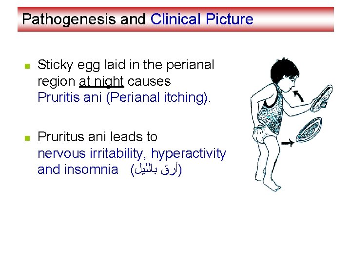 Pathogenesis and Clinical Picture n n Sticky egg laid in the perianal region at