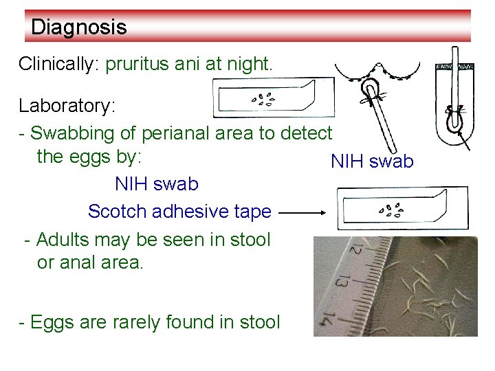 Diagnosis Clinically: pruritus ani at night. Laboratory: - Swabbing of perianal area to detect