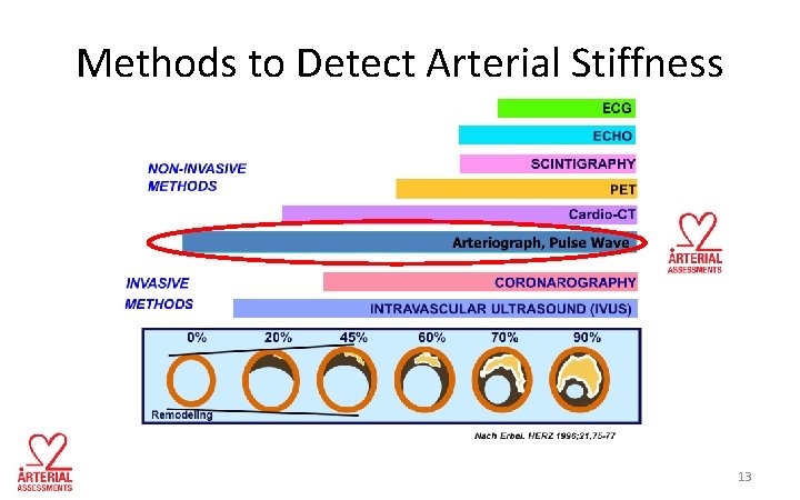 Methods to Detect Arterial Stiffness 13 