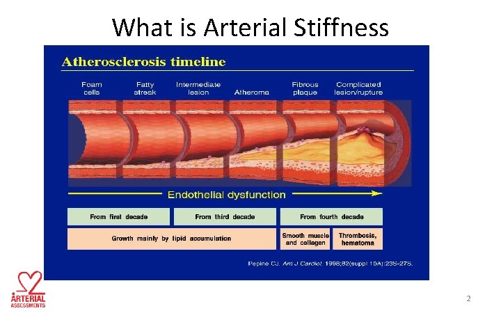 What is Arterial Stiffness 2 
