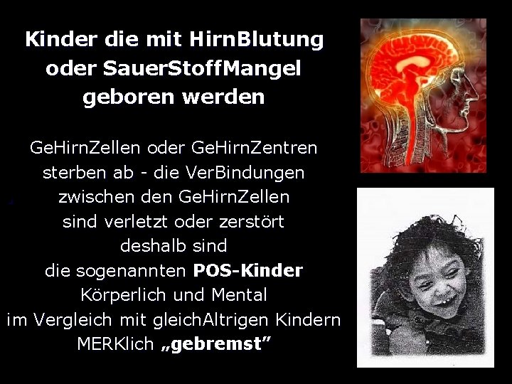 Kinder die mit Hirn. Blutung oder Sauer. Stoff. Mangel geboren werden Ge. Hirn. Zellen