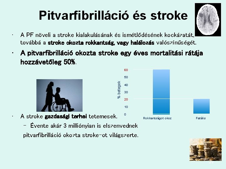 Pitvarfibrilláció és stroke • A PF növeli a stroke kialakulásának és ismétlődésének kockázatát, továbbá