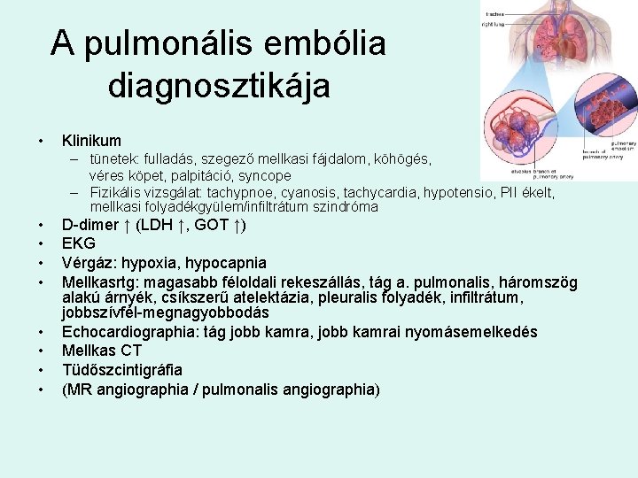 A pulmonális embólia diagnosztikája • Klinikum – tünetek: fulladás, szegező mellkasi fájdalom, köhögés, véres