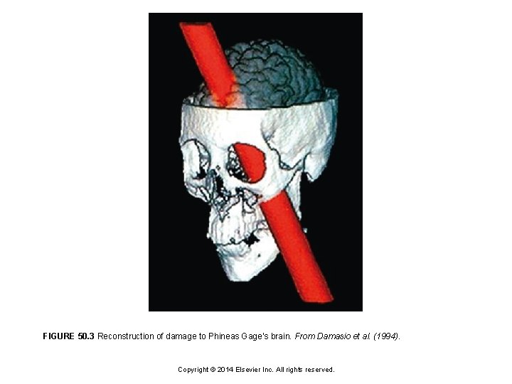 FIGURE 50. 3 Reconstruction of damage to Phineas Gage’s brain. From Damasio et al.