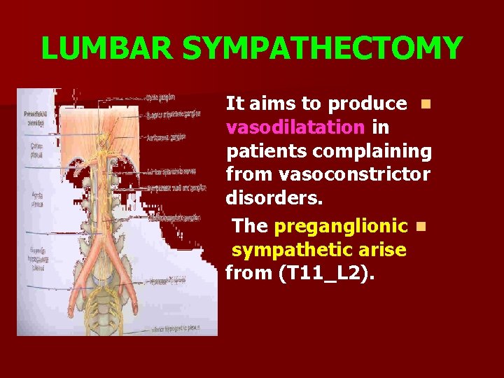 LUMBAR SYMPATHECTOMY It aims to produce n vasodilatation in patients complaining from vasoconstrictor disorders.