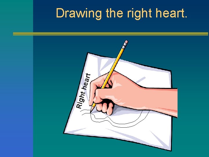 Righ t hea rt Drawing the right heart. 
