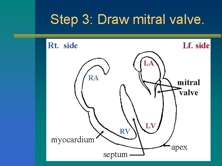 Step 3: Draw mitral valve. Rt. side Lf. side LA RA myocardium mitral valve