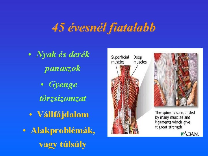 45 évesnél fiatalabb • Nyak és derék panaszok • Gyenge törzsizomzat • Vállfájdalom •