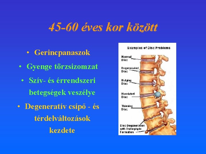 45 -60 éves kor között • Gerincpanaszok • Gyenge törzsizomzat • Szív- és érrendszeri