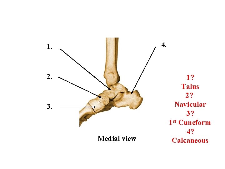 4. 1. 2. 3. Medial view 1? Talus 2? Navicular 3? 1 st Cuneform