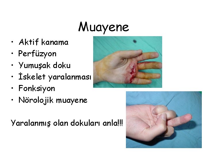 Muayene • • • Aktif kanama Perfüzyon Yumuşak doku İskelet yaralanması Fonksiyon Nörolojik muayene