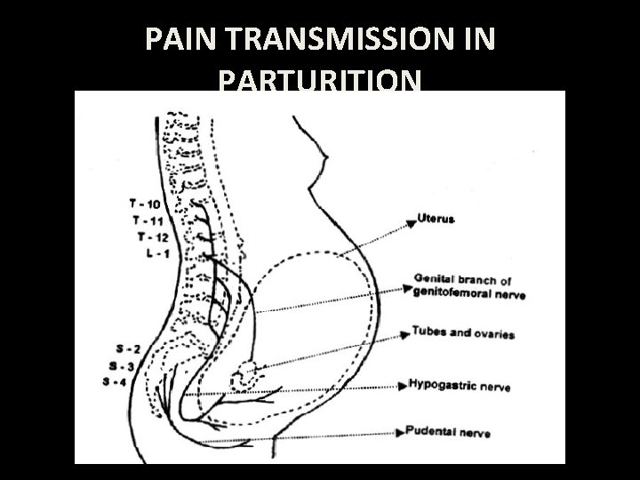 PAIN TRANSMISSION IN PARTURITION 