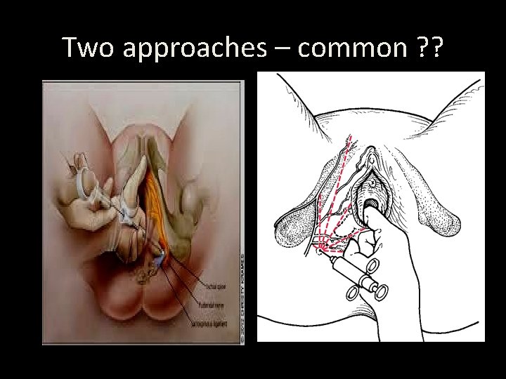 Two approaches – common ? ? 