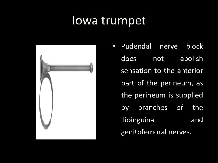 Iowa trumpet • Pudendal does nerve not block abolish sensation to the anterior part
