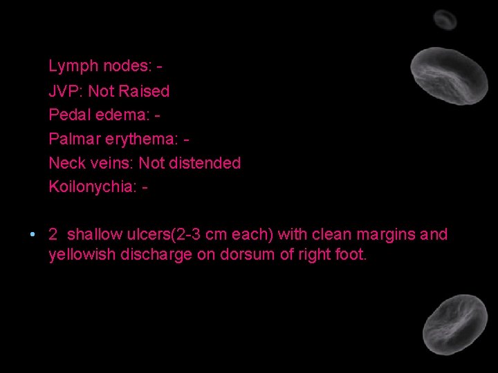 Lymph nodes: JVP: Not Raised Pedal edema: Palmar erythema: Neck veins: Not distended Koilonychia: