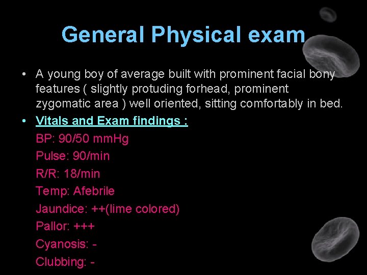 General Physical exam • A young boy of average built with prominent facial bony