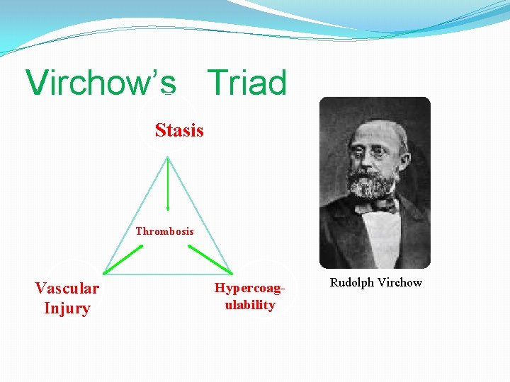 Virchow’s Triad Stasis Thrombosis Vascular Injury Hypercoagulability Rudolph Virchow 