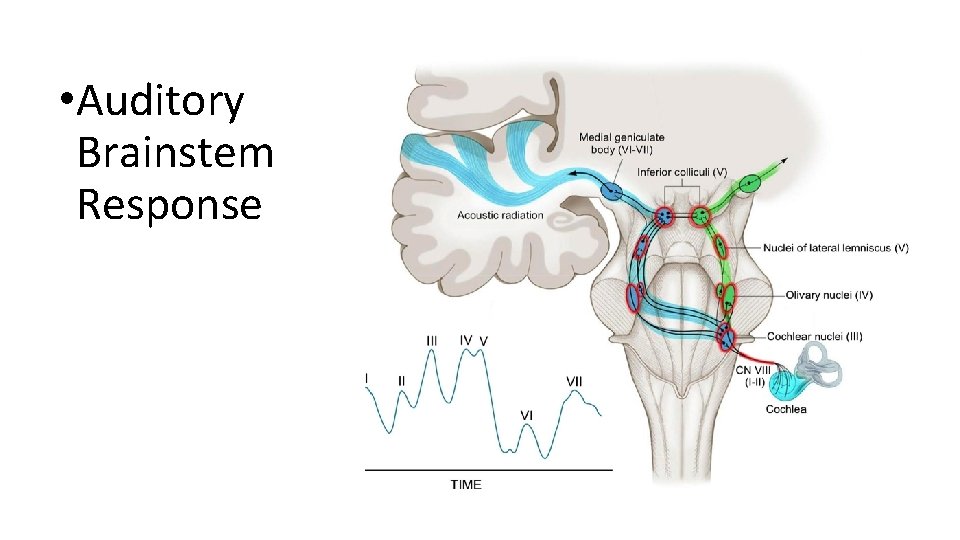  • Auditory Brainstem Response 