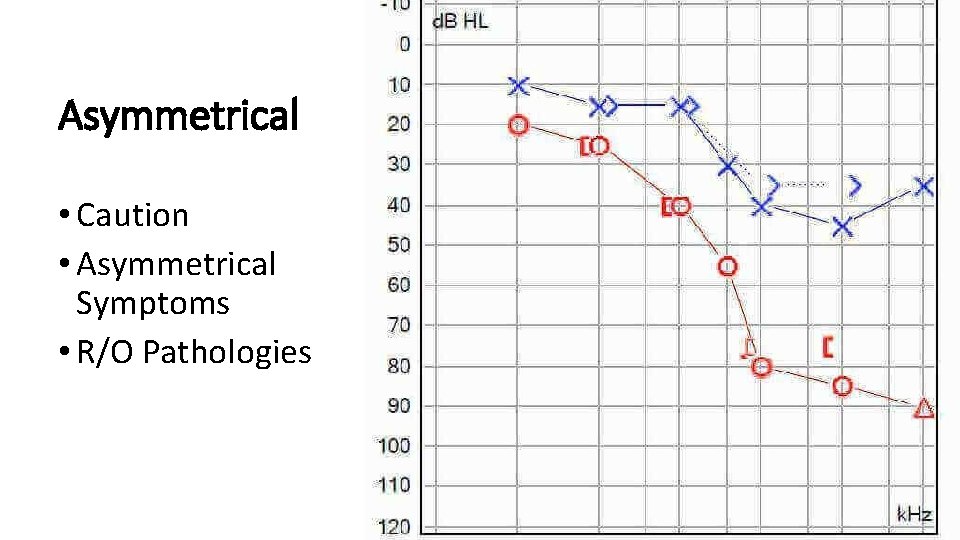 Asymmetrical • Caution • Asymmetrical Symptoms • R/O Pathologies 