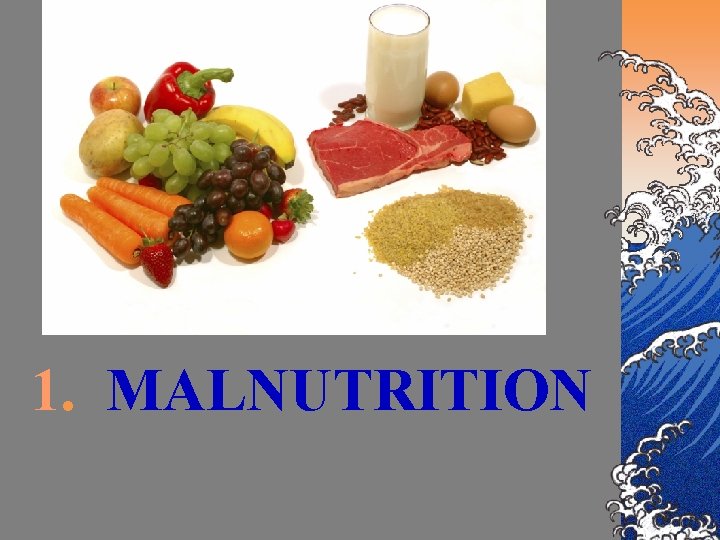 1. MALNUTRITION 