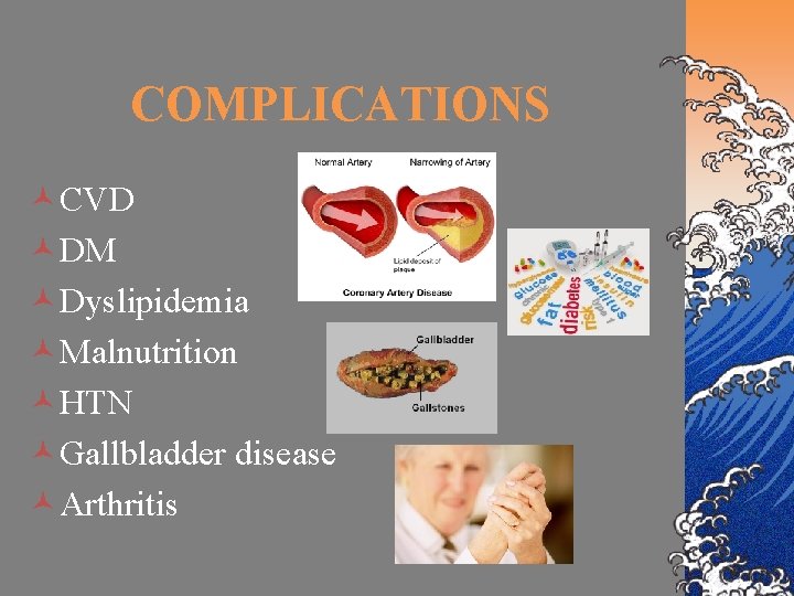 COMPLICATIONS ©CVD ©DM ©Dyslipidemia ©Malnutrition ©HTN ©Gallbladder disease ©Arthritis 