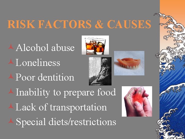 RISK FACTORS & CAUSES ©Alcohol abuse ©Loneliness ©Poor dentition ©Inability to prepare food ©Lack
