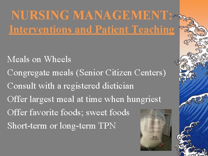 NURSING MANAGEMENT: Interventions and Patient Teaching Meals on Wheels Congregate meals (Senior Citizen Centers)