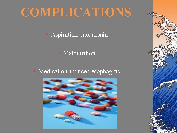 COMPLICATIONS © Aspiration pneumonia © Malnutrition © Medication-induced esophagitis 