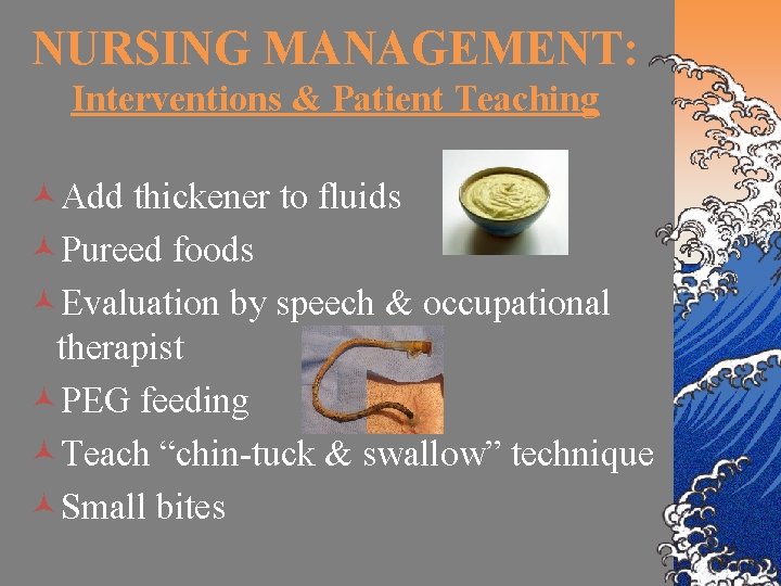 NURSING MANAGEMENT: Interventions & Patient Teaching ©Add thickener to fluids ©Pureed foods ©Evaluation by
