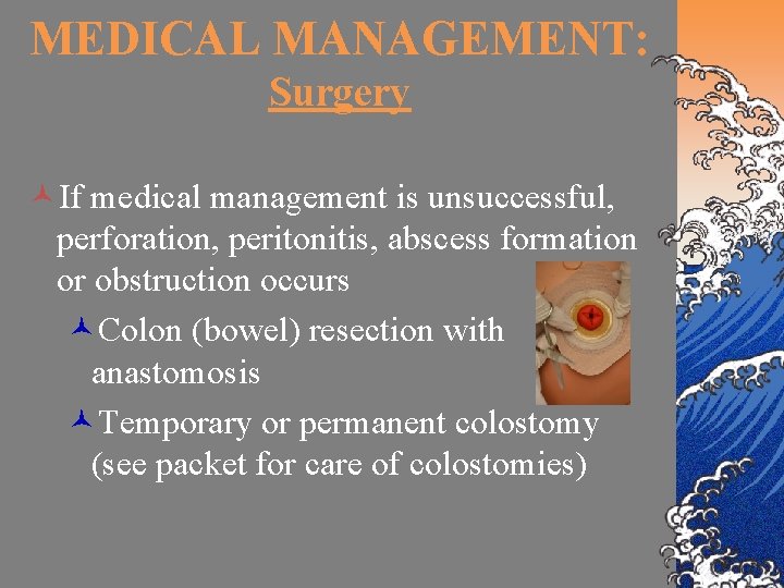 MEDICAL MANAGEMENT: Surgery ©If medical management is unsuccessful, perforation, peritonitis, abscess formation or obstruction