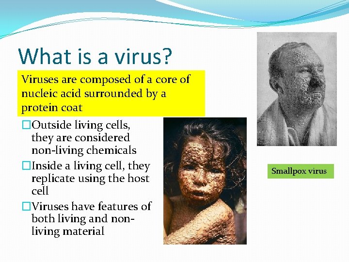 What is a virus? Viruses are composed of a core of nucleic acid surrounded