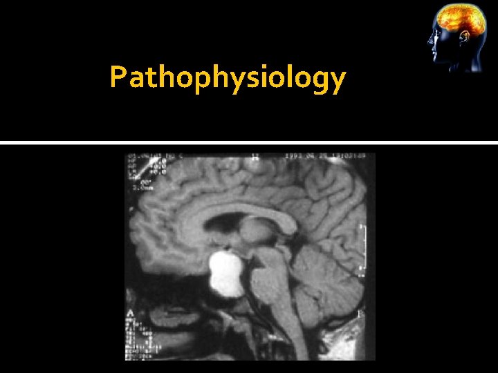 Pathophysiology 