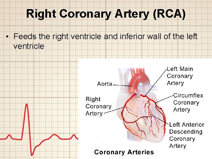 Right Coronary Artery (RCA) • Feeds the right ventricle and inferior wall of the