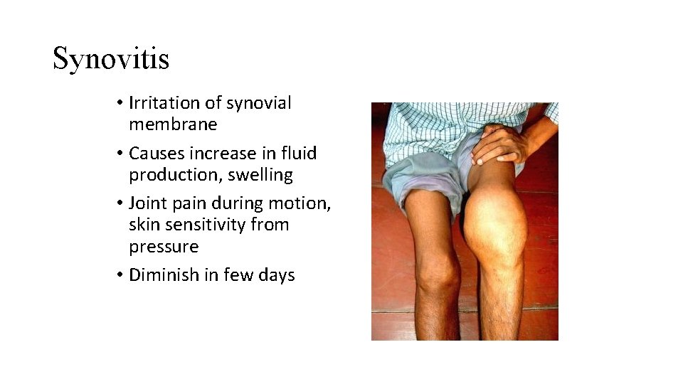 Synovitis • Irritation of synovial membrane • Causes increase in fluid production, swelling •