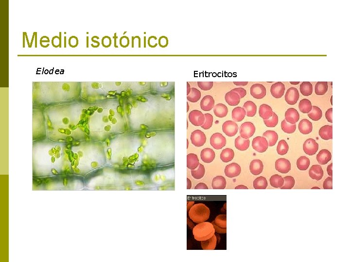 Medio isotónico Elodea Eritrocitos 