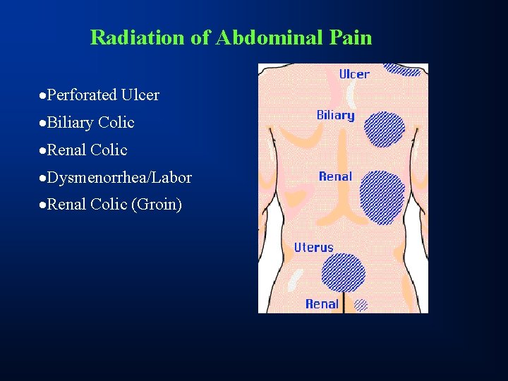 Radiation of Abdominal Pain ·Perforated Ulcer ·Biliary Colic ·Renal Colic ·Dysmenorrhea/Labor ·Renal Colic (Groin)