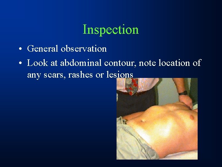 Inspection • General observation • Look at abdominal contour, note location of any scars,